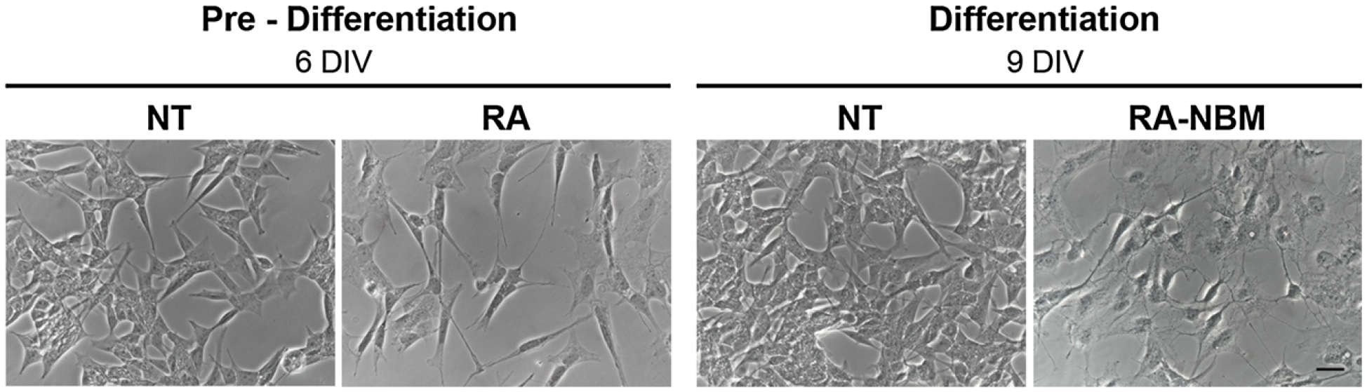 Morphological analysis of differentiated SH-SY5Y cells.<br>At 6-DIV stage, the cells exposed to RA showed an elongated morphology as compared to basal medium (NT). Cells subsequently treated in NBM for 3 days became more polarised, exhibited several neurites and branches and acquired a neuronal-like shape<br><br>Image is derived from Figure 4 (Pezzini et al. 2017).