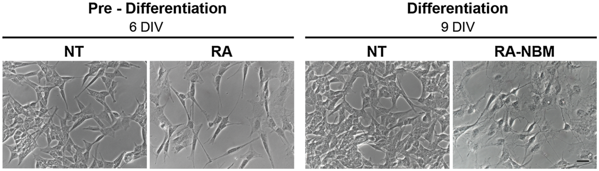 Morphological analysis of differentiated SH-SY5Y cells.<br>At 6-DIV stage, the cells exposed to RA showed an elongated morphology as compared to basal medium (NT). Cells subsequently treated in NBM for 3 days became more polarised, exhibited several neurites and branches and acquired a neuron-like shape<br><br>Image is derived from Figure 4 (Pezzini et al. 2017).